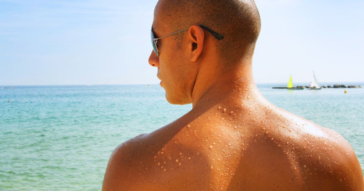 Why Do I Break Out More in Summer? Sweat, Body Acne, and How to Stop It
