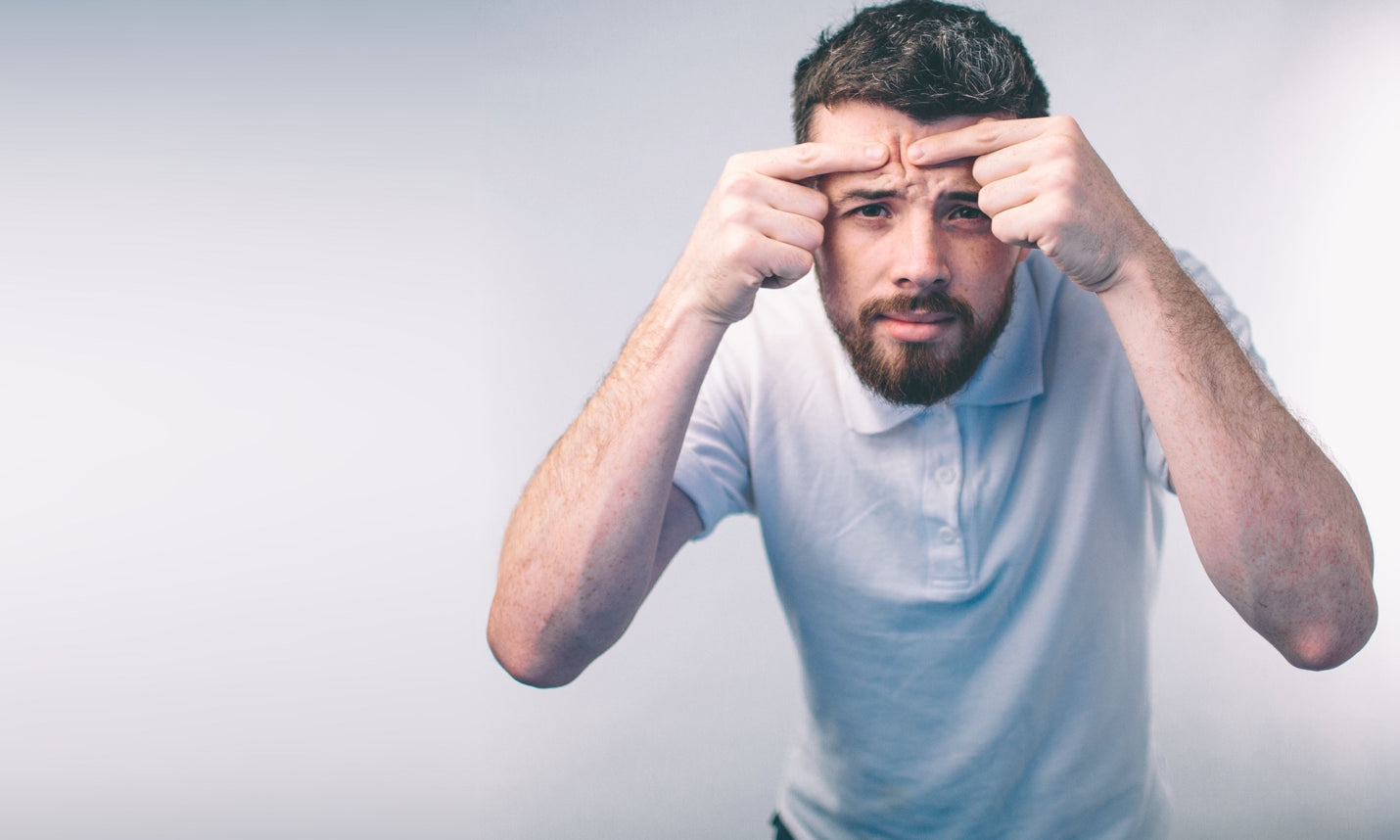 Man squeezing pimple on his forehead