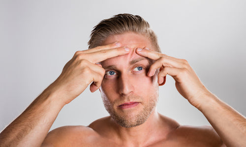 man squeezing pimple
