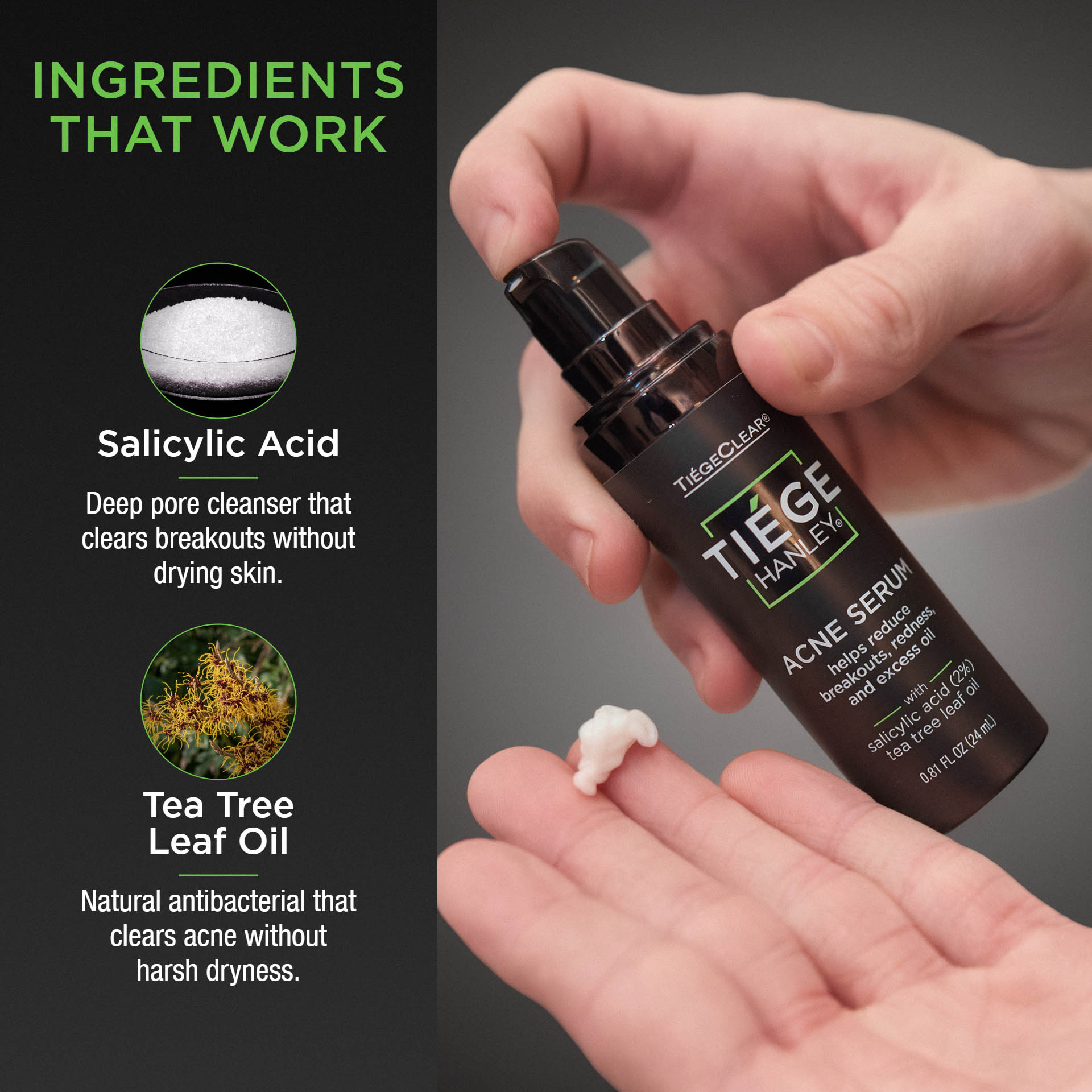 Image link to PDP for ACNE SERUM