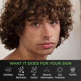 Level 3: The TiegeClear® ACNE Complete Routine